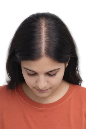 Less volume, no visible thinning