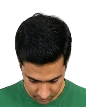 Stage 1