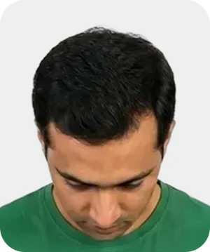 Stage 2