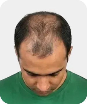 Stage 5