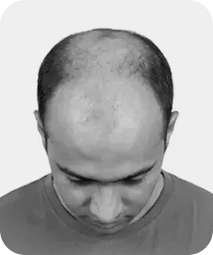 Stage 6
