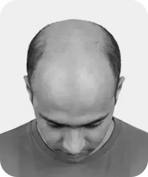Stage 7